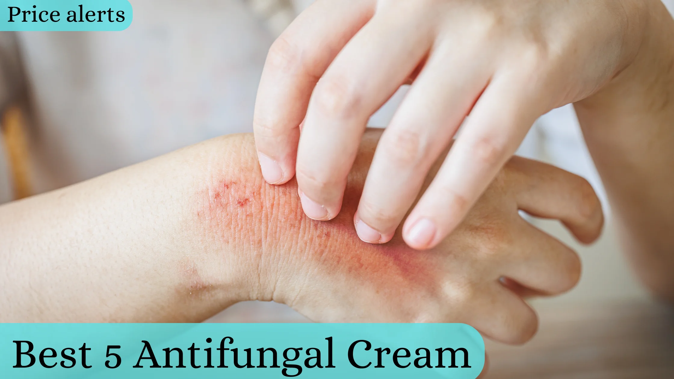 Antifungal Cream in Pakistan